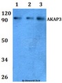 AKAP110 / AKAP3 Antibody - Western blot of AKAP3 antibody at 1:500 Line1:HeLa whole cell lysate Line2:H9C2 whole cell lysate Line3:Raw264.7 whole cell lysate.