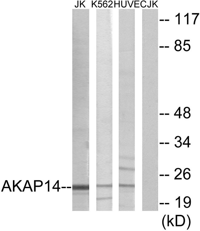 AKAP14 Antibody - Western blot analysis of lysates from Jurkat, K562, and HUVEC cells, using AKAP14 Antibody. The lane on the right is blocked with the synthesized peptide.