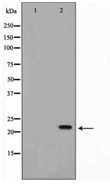 AKAP14 Antibody - Western blot of Jurkat cell lysate using AKAP14 Antibody
