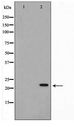 AKAP14 Antibody - Western blot of Jurkat cell lysate using AKAP14 Antibody