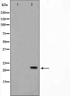 AKAP14 Antibody - Western blot analysis on Jurkat cell lysates using AKAP14 antibody. The lane on the left is treated with the antigen-specific peptide.