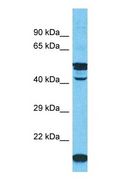 AKAP14 Antibody - Western blot of AKAP14 Antibody with human HeLa Whole Cell lysate.  This image was taken for the unconjugated form of this product. Other forms have not been tested.