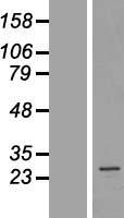 AKAP14 Protein - Western validation with an anti-DDK antibody * L: Control HEK293 lysate R: Over-expression lysate