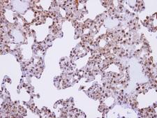 AKAP17A / 721P Antibody - IHC of paraffin-embedded lung using XE7 antibody at 1:100 dilution.