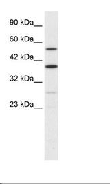 AKAP17A / 721P Antibody - Jurkat Cell Lysate.  This image was taken for the unconjugated form of this product. Other forms have not been tested.