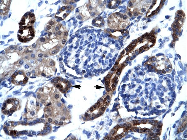 AKAP17A / 721P Antibody - AKAP17A / SFRS17A antibody ARP34208_P050-NP_005079-DXYS155E Antibody was used in IHC to stain formalin-fixed, paraffin-embedded human kidney.  This image was taken for the unconjugated form of this product. Other forms have not been tested.