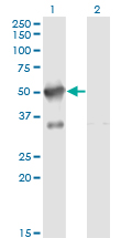 AKAP17A / 721P Antibody - Western blot of SFRS17A expression in transfected 293T cell line by RP13-297E16.1 monoclonal antibody (M02), clone 2G8.