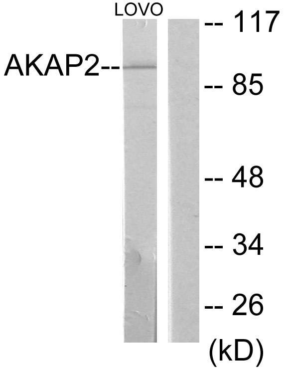 AKAP2 Antibody - Western blot analysis of lysates from LOVO cells, using AKAP2 Antibody. The lane on the right is blocked with the synthesized peptide.