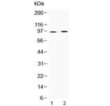 AKAP2 Antibody - Western blot testing of 1) rat heart and 2) human HepG2 lysate with AKAP2 antibody at 0.5ug/ml. Predicted molecular weight ~95 kDa.