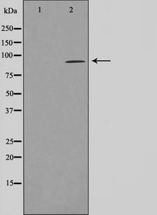 AKAP2 Antibody - Western blot analysis on LOVO cells cell lysates using AKAP2 antibody. The lane on the left is treated with the antigen-specific peptide.