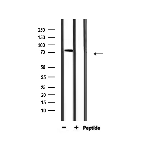 AKAP2 Antibody - Western blot analysis of extracts of 293 cells and HeLa cells using AKAP2 antibody.