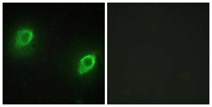 AKAP5 / AKAP79 Antibody - Immunofluorescence analysis of HeLa cells, using AKAP5 Antibody. The picture on the right is blocked with the synthesized peptide.