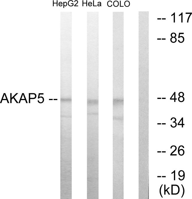 AKAP5 / AKAP79 Antibody - Western blot analysis of lysates from HepG2, HeLa, and COLO205 cells, using AKAP5 Antibody. The lane on the right is blocked with the synthesized peptide.