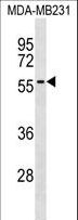 AKAP5 / AKAP79 Antibody - AKAP5 Antibody western blot of MDA-MB231 cell line lysates (35 ug/lane). The AKAP5 antibody detected the AKAP5 protein (arrow).