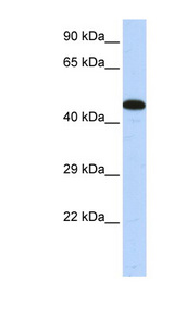 AKAP5 / AKAP79 Antibody - AKAP5 antibody Western blot of Fetal Muscle lysate. This image was taken for the unconjugated form of this product. Other forms have not been tested.
