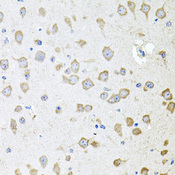 AKAP5 / AKAP79 Antibody - Immunohistochemistry of paraffin-embedded mouse brain tissue.