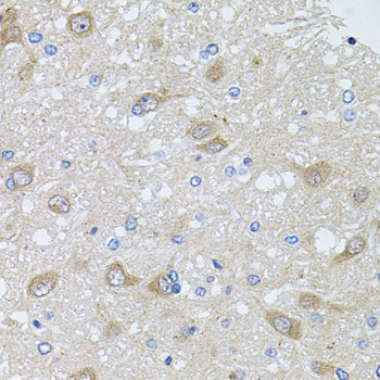 AKAP5 / AKAP79 Antibody - Immunohistochemistry of paraffin-embedded rat brain tissue.