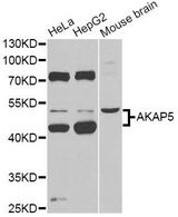 AKAP5 / AKAP79 Antibody - Western blot analysis of extracts of various cell lines, using AKAP5 Antibody at 1:1000 dilution. The secondary antibody used was an HRP Goat Anti-Rabbit IgG (H+L) at 1:10000 dilution. Lysates were loaded 25ug per lane and 3% nonfat dry milk in TBST was used for blocking. An ECL Kit was used for detection and the exposure time was 30s.