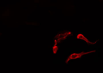 AKAP5 / AKAP79 Antibody - Staining HepG2 cells by IF/ICC. The samples were fixed with PFA and permeabilized in 0.1% Triton X-100, then blocked in 10% serum for 45 min at 25°C. The primary antibody was diluted at 1:200 and incubated with the sample for 1 hour at 37°C. An Alexa Fluor 594 conjugated goat anti-rabbit IgG (H+L) antibody, diluted at 1/600, was used as secondary antibody.