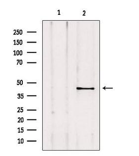 AKAP5 / AKAP79 Antibody - Western blot analysis of extracts of mouse lung using AKAP5 antibody. Lane 1 was treated with the blocking peptide.