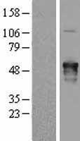 AKAP5 / AKAP79 Protein - Western validation with an anti-DDK antibody * L: Control HEK293 lysate R: Over-expression lysate