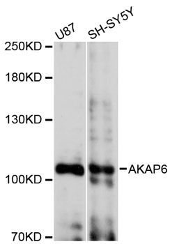 AKAP6 / MAKAP Antibody - Western blot analysis of extracts of various cell lines, using AKAP6 antibody at 1:3000 dilution. The secondary antibody used was an HRP Goat Anti-Rabbit IgG (H+L) at 1:10000 dilution. Lysates were loaded 25ug per lane and 3% nonfat dry milk in TBST was used for blocking. An ECL Kit was used for detection and the exposure time was 90s.
