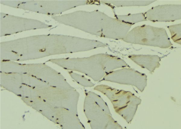 AKAP6 / MAKAP Antibody - 1:100 staining mouse muscle tissue by IHC-P. The sample was formaldehyde fixed and a heat mediated antigen retrieval step in citrate buffer was performed. The sample was then blocked and incubated with the antibody for 1.5 hours at 22°C. An HRP conjugated goat anti-rabbit antibody was used as the secondary.