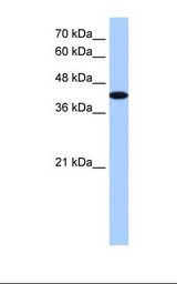 AKAP7 Antibody - HepG2 cell lysate. Antibody concentration: 1.25 ug/ml. Gel concentration: 12%.  This image was taken for the unconjugated form of this product. Other forms have not been tested.