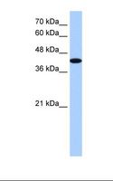AKAP7 Antibody - HepG2 cell lysate. Antibody concentration: 1.25 ug/ml. Gel concentration: 12%.  This image was taken for the unconjugated form of this product. Other forms have not been tested.