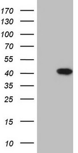 AKAP7 Antibody - HEK293T cells were transfected with the pCMV6-ENTRY control (Left lane) or pCMV6-ENTRY AKAP7 (Right lane) cDNA for 48 hrs and lysed. Equivalent amounts of cell lysates (5 ug per lane) were separated by SDS-PAGE and immunoblotted with anti-AKAP7.