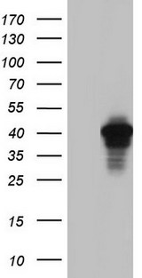 AKAP7 Antibody - HEK293T cells were transfected with the pCMV6-ENTRY control. (Left lane) or pCMV6-ENTRY AKAP7. (Right lane) cDNA for 48 hrs and lysed. Equivalent amounts of cell lysates. (5 ug per lane) were separated by SDS-PAGE and immunoblotted with anti-AKAP7.