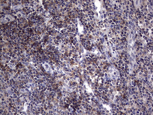 AKAP7 Antibody - Immunohistochemical staining of paraffin-embedded Human tonsil within the normal limits using anti-AKAP7 Mouse monoclonal antibody.  heat-induced epitope retrieval by 1 mM EDTA in 10mM Tris, pH8.5, 120C for 3min)