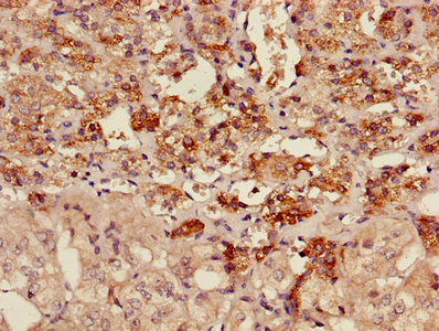 AKAP7 Antibody - Immunohistochemistry of paraffin-embedded human adrenal gland tissue using AKAP7 Antibody at dilution of 1:100