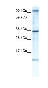 AKAP7 Antibody - AKAP7 antibody Western blot of Fetal brain lysate. This image was taken for the unconjugated form of this product. Other forms have not been tested.