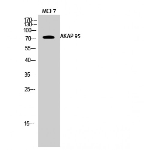 AKAP8 / AKAP95 Antibody - Western blot of AKAP 95 antibody