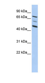 AKAP8 / AKAP95 Antibody - AKAP8 antibody Western blot of HepG2 cell lysate. This image was taken for the unconjugated form of this product. Other forms have not been tested.