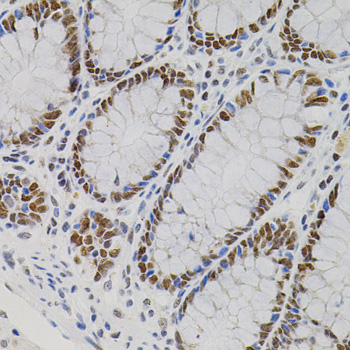 AKAP8 / AKAP95 Antibody - Immunohistochemistry of paraffin-embedded human colon tissue.