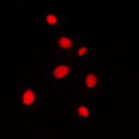 AKAP8 / AKAP95 Antibody - Immunofluorescent analysis of AKAP8 staining in Jurkat cells. Formalin-fixed cells were permeabilized with 0.1% Triton X-100 in TBS for 5-10 minutes and blocked with 3% BSA-PBS for 30 minutes at room temperature. Cells were probed with the primary antibody in 3% BSA-PBS and incubated overnight at 4 C in a humidified chamber. Cells were washed with PBST and incubated with a DyLight 594-conjugated secondary antibody (red) in PBS at room temperature in the dark. DAPI was used to stain the cell nuclei (blue).