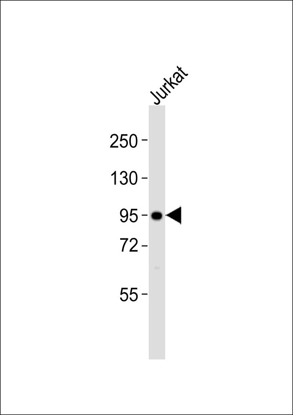 AKAP8 / AKAP95 Antibody - Anti-AKAP8 Antibody at 1:1000 dilution + Jurkat whole cell lysates Lysates/proteins at 20 ug per lane. Secondary Goat Anti-Rabbit IgG, (H+L),Peroxidase conjugated at 1/10000 dilution Predicted band size : 76 kDa Blocking/Dilution buffer: 5% NFDM/TBST.