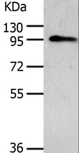 AKAP8 / AKAP95 Antibody - Western blot analysis of Human liver cancer tissue, using AKAP8 Polyclonal Antibody at dilution of 1:500.