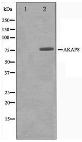 AKAP8 / AKAP95 Antibody - Western blot of Jurkat cell lysate using AKAP8 Antibody