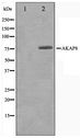 AKAP8 / AKAP95 Antibody - Western blot of Jurkat cell lysate using AKAP8 Antibody