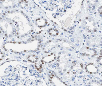 AKAP8 / AKAP95 Antibody - 1:100 staining human kidney tissue by IHC-P. The tissue was formaldehyde fixed and a heat mediated antigen retrieval step in citrate buffer was performed. The tissue was then blocked and incubated with the antibody for 1.5 hours at 22°C. An HRP conjugated goat anti-rabbit antibody was used as the secondary.