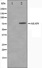 AKAP8 / AKAP95 Antibody - Western blot analysis on Jurkat cell lysates using AKAP8 antibody. The lane on the left is treated with the antigen-specific peptide.