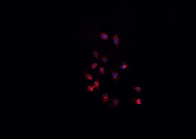 AKAP8 / AKAP95 Antibody - Staining HeLa cells by IF/ICC. The samples were fixed with PFA and permeabilized in 0.1% Triton X-100, then blocked in 10% serum for 45 min at 25°C. The primary antibody was diluted at 1:200 and incubated with the sample for 1 hour at 37°C. An Alexa Fluor 594 conjugated goat anti-rabbit IgG (H+L) Ab, diluted at 1/600, was used as the secondary antibody.