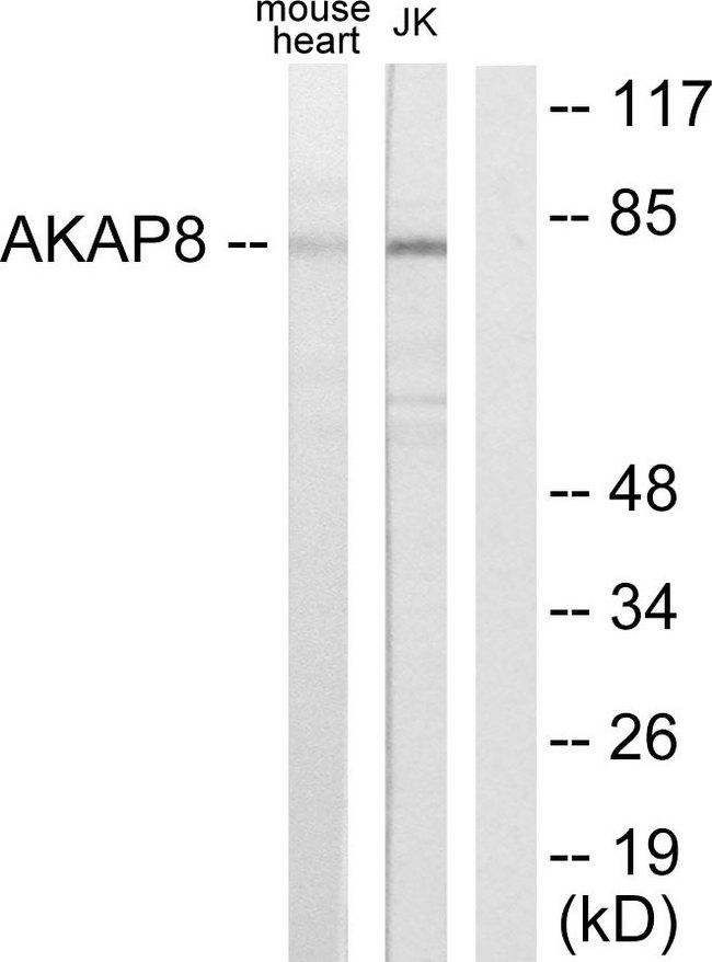 AKAP8 / AKAP95 Antibody - Western blot analysis of extracts from mouse heart cells and Jurkat cells, using AKAP8 antibody.