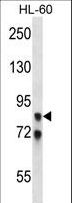 AKAP82 / AKAP4 Antibody - AKAP4 Antibody western blot of HL-60 cell line lysates (35 ug/lane). The AKAP4 antibody detected the AKAP4 protein (arrow).