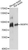 AKAP82 / AKAP4 Antibody - Western blot analysis of extracts of various cell lines, using AKAP4 antibody at 1:1000 dilution. The secondary antibody used was an HRP Goat Anti-Rabbit IgG (H+L) at 1:10000 dilution. Lysates were loaded 25ug per lane and 3% nonfat dry milk in TBST was used for blocking. An ECL Kit was used for detection and the exposure time was 3s.