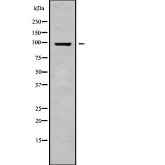 AKAP82 / AKAP4 Antibody - Western blot analysis of AKAP4 using COLO205 whole cells lysates