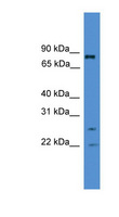AKAP8L Antibody - AKAP8L antibody Western blot of Jurkat lysate. This image was taken for the unconjugated form of this product. Other forms have not been tested.